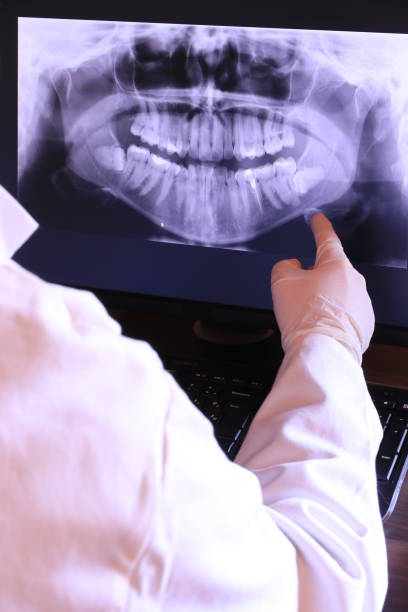 Best Emergency Gum Treatment in Syracuse, NE